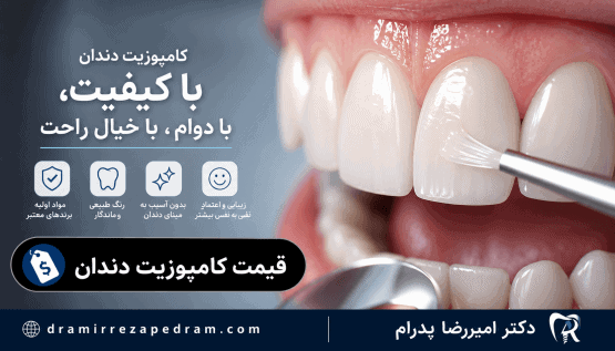 قیمت کامپوزیت دندان