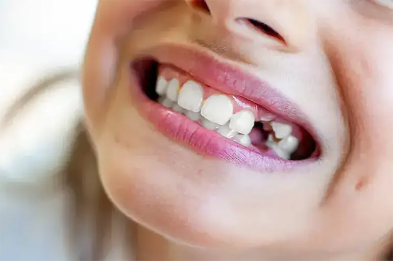 تروما دندان چگونه به وجود میآید 