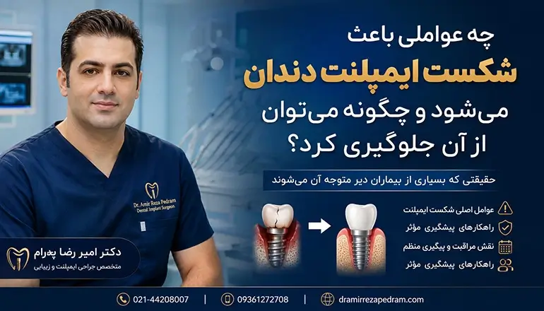 شکست ایمپلنت دندان