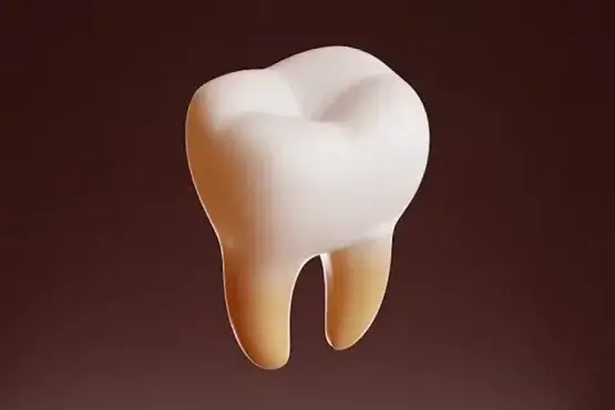 لمینت سرامیکی چیست