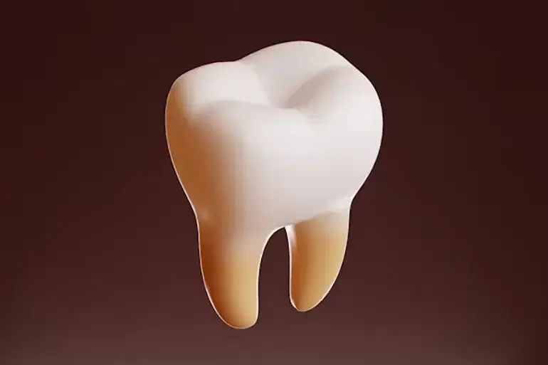لمینت سرامیکی چیست