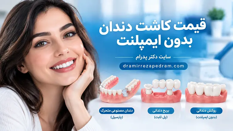 قیمت کاشت دندان بدون ایمپلنت