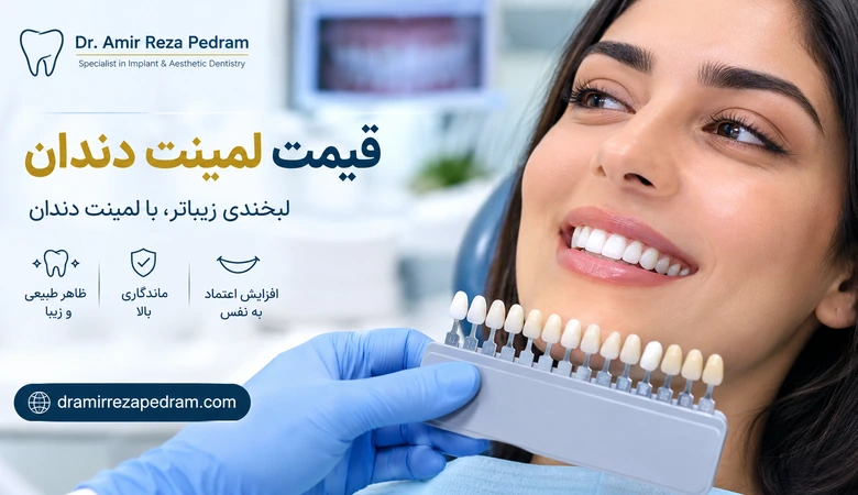 قیمت لمینت دندان