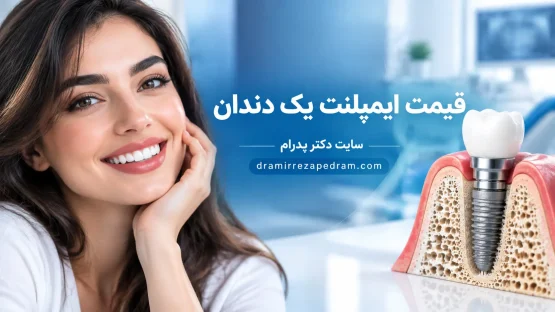 قیمت ایمپلنت یک دندان