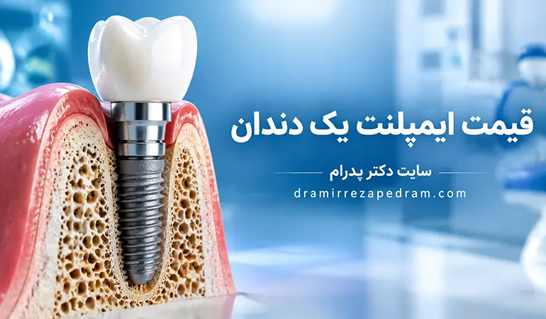 قیمت ایمپلنت یک دندان dramirrezapedram.com The main subject is ONE single dental implant. Show a medically accurate cross-sectional view of the jawbone and gum containing: - titanium dental implant - implant fixture - abutment - realistic white zirconia crown - natural gum tissue - detailed jawbone The implant should be large enough to clearly understand the treatment while maintaining an elegant professional composition. Use a premium medical blue and white background with soft studio lighting, subtle reflections and cinematic depth. Place this exact Persian headline in the CENTER: «قیمت ایمپلنت یک دندان» Also include: «سایت دکتر پدرام» «dramirrezapedram.com» Modern Persian typography, highly readable, elegant white text, subtle shadow/contrast. Ultra-realistic medical 3D visualization, 8K, photorealistic materials, anatomically accurate, premium dental clinic website advertising, clean, sophisticated, trustworthy and technologically advanced.